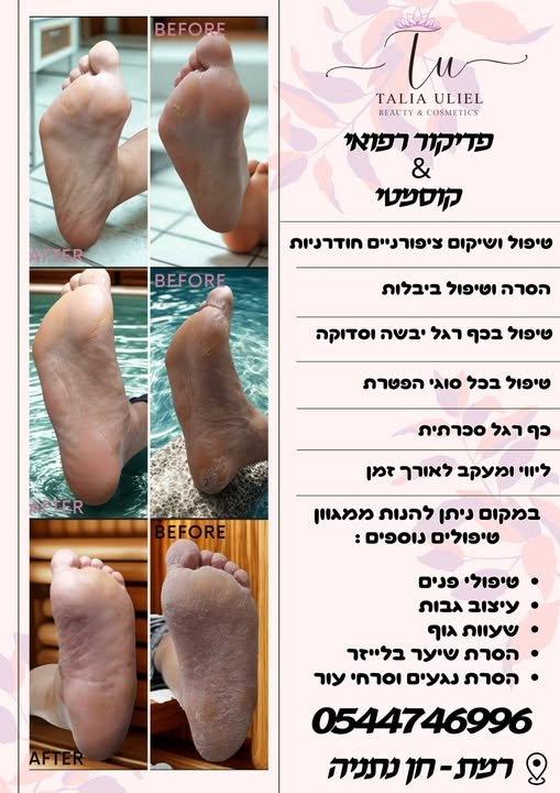 דרוש/ה מטפל/ת בהסרת שיער בלייזר/IPL בנתניה